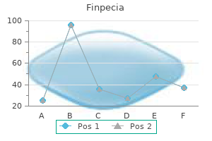 cheap 1 mg finpecia with visa