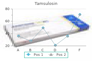 generic 0.4 mg tamsulosin amex