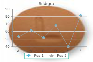 purchase 50 mg sildigra visa