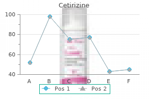 buy cetirizine 5 mg mastercard